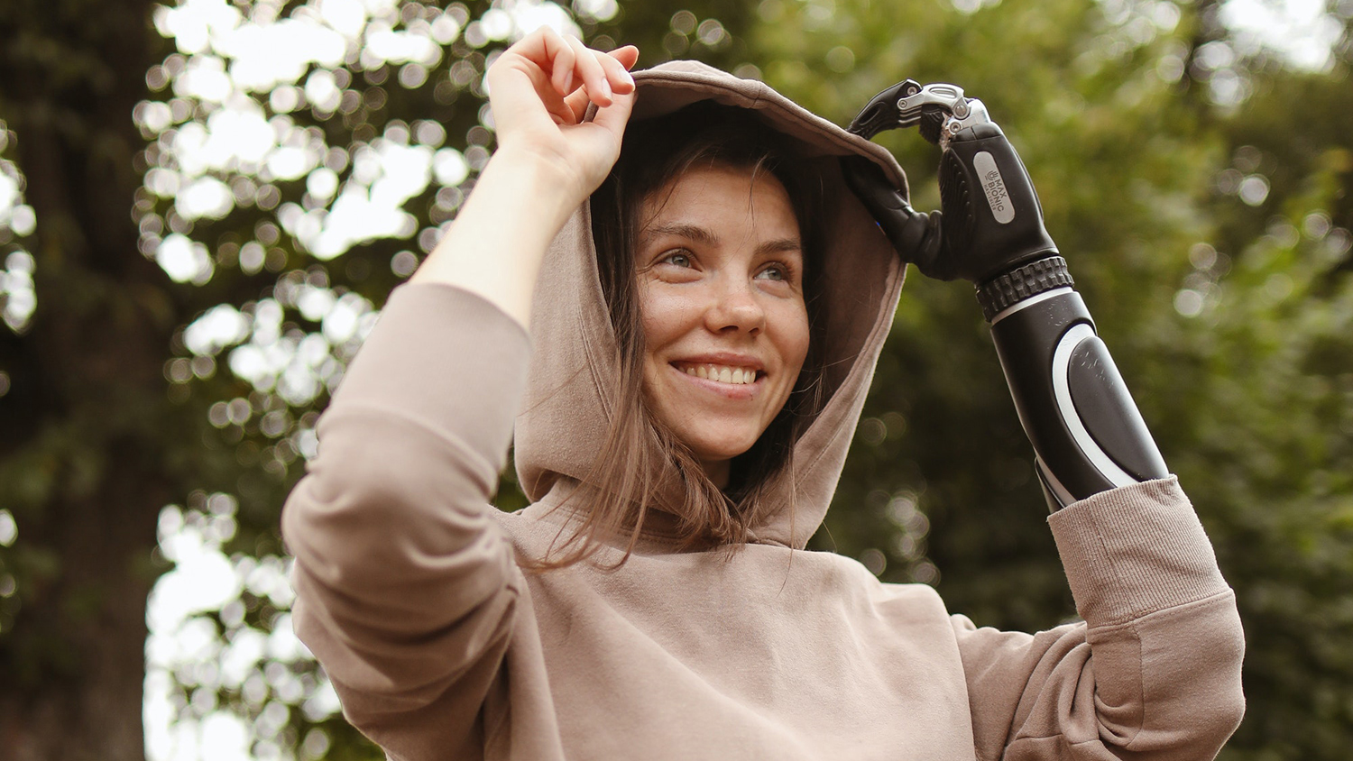 Жінка з протезом на руці - страхування від нещасних випадків на виробництві Жінка з протезом на руці - страхування від нещасних випадків на виробництві